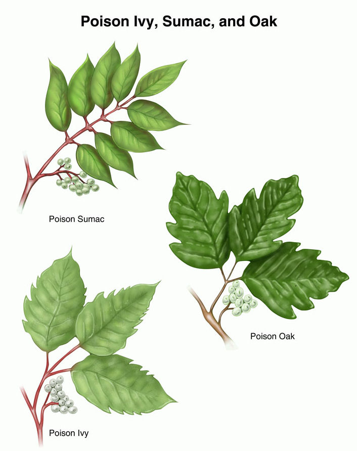 How To Identify Poison Ivy Oak And Sumac And Treatments Remedies